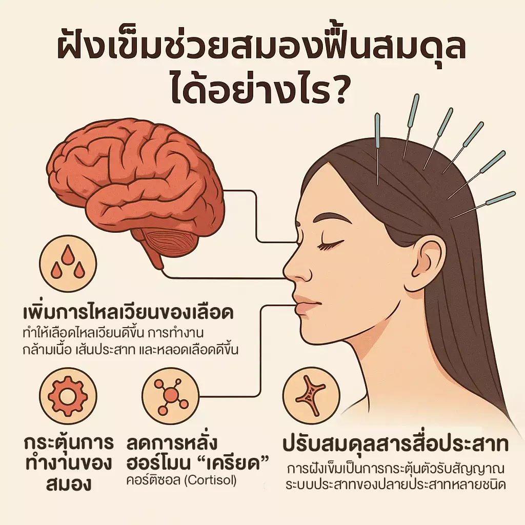 ฝังเข็ม ฝังเข็มออฟฟิศซินโดรม คลินิกแพทย์แผนจีน รีวิวฝังเข็ม คลินิกฝังเข็ม ครอบแก้ว ปรับสมดุล ฝังเข็มราคาถูก ฝังเข็มรักษาโรค ฝังเข็มแก้ปวด ฝังเข็มช่วยอะไร ฝังเข็มสมอง ฝังเข็มหน้าใส ฝังเข็ม หมอฝังเข็ม ฝังเข็มใกล้ฉัน คลินิกแพทย์แผนจีน คลินิกฝังเข็ม คลินิกฝังเข็มใกล้ฉัน ฝังเข็มแก้ปวดเข่า คลินิกฝังเข็มมาตรฐาน