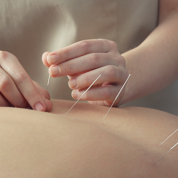 ฝังเข็ม ฝังเข็มออฟฟิศซินโดรม คลินิกแพทย์แผนจีน รีวิวฝังเข็ม คลินิกฝังเข็ม ครอบแก้ว ปรับสมดุล ฝังเข็มราคาถูก ฝังเข็มรักษาโรค ฝังเข็มแก้ปวด ฝังเข็มช่วยอะไร ฝังเข็มสมอง ฝังเข็มหน้าใส ฝังเข็ม หมอฝังเข็ม ฝังเข็มใกล้ฉัน คลินิกแพทย์แผนจีน คลินิกฝังเข็ม คลินิกฝังเข็มใกล้ฉัน ฝังเข็มแก้ปวดเข่า คลินิกฝังเข็มมาตรฐาน