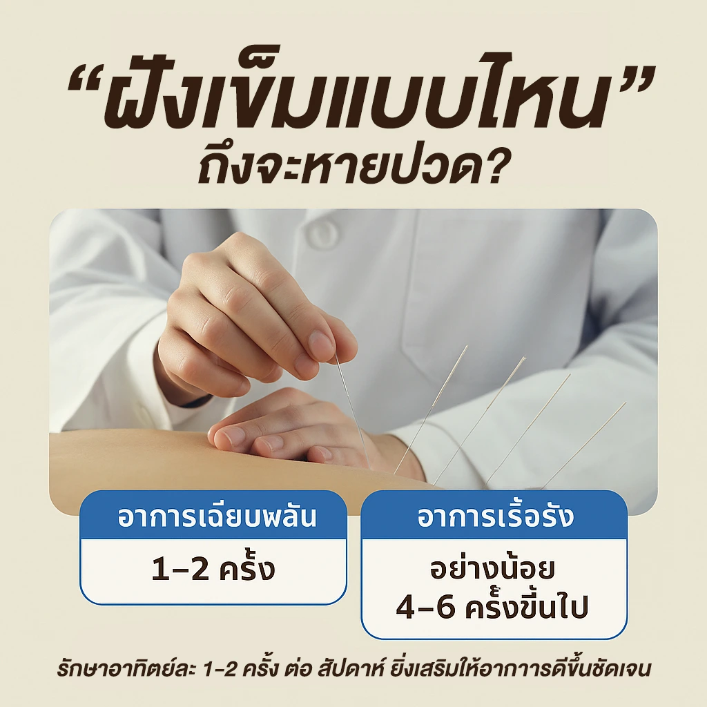 ฝังเข็ม  ฝังเข็มออฟฟิศซินโดรม คลินิกแพทย์แผนจีน รีวิวฝังเข็ม คลินิกฝังเข็ม ครอบแก้ว ปรับสมดุล ฝังเข็มราคาถูก ฝังเข็มรักษาโรค ฝังเข็มแก้ปวด ฝังเข็มช่วยอะไร ฝังเข็มสมอง ฝังเข็มหน้าใส ฝังเข็ม หมอฝังเข็ม ฝังเข็มใกล้ฉัน คลินิกแพทย์แผนจีน คลินิกฝังเข็ม คลินิกฝังเข็มใกล้ฉัน ฝังเข็มแก้ปวดเข่า คลินิกฝังเข็มมาตรฐาน ฝังเข็ม ฝังเข็มออฟฟิศซินโดรม คลินิกแพทย์แผนจีน รีวิวฝังเข็ม คลินิกฝังเข็ม ครอบแก้ว ปรับสมดุล ฝังเข็มราคาถูก ฝังเข็มรักษาโรค ฝังเข็มแก้ปวด ฝังเข็มช่วยอะไร ฝังเข็มสมอง ฝังเข็มหน้าใส ฝังเข็ม หมอฝังเข็ม ฝังเข็มใกล้ฉัน คลินิกแพทย์แผนจีน คลินิกฝังเข็ม คลินิกฝังเข็มใกล้ฉัน ฝังเข็มแก้ปวดเข่า คลินิกฝังเข็มมาตรฐาน