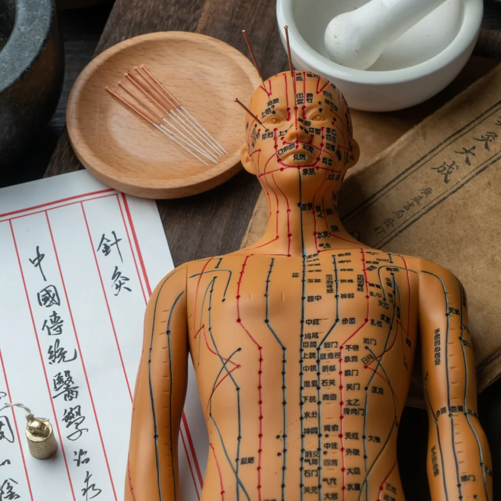 ฝังเข็มปรับสมดุลพลังชีวิต ฝังเข็มเน้นกล้ามเนื้อและระบบประสาท ผสานทั้ง 2 ศาสตร์ในหนึ่งเดียว